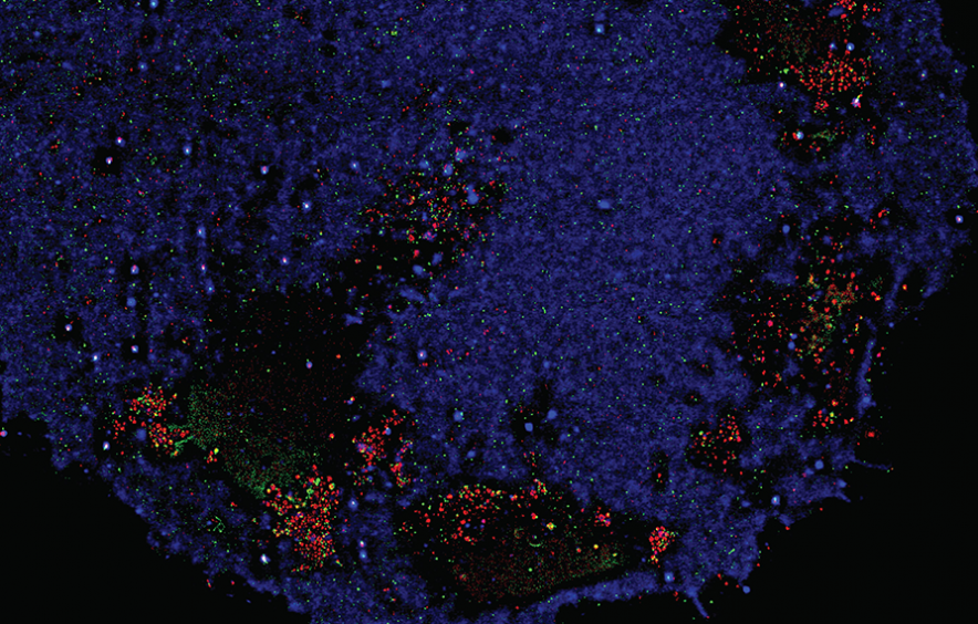 HIV-1-infected t cell