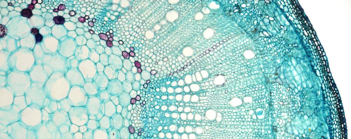 pllant cells under microscope